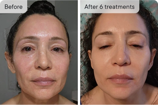 Before and after image