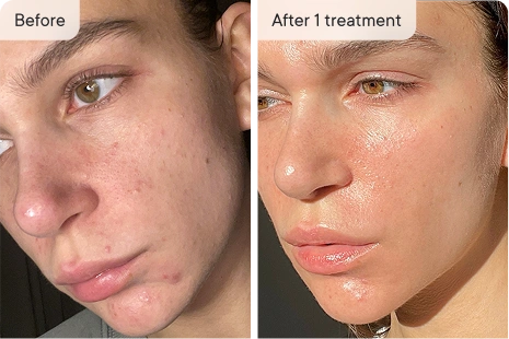Before and after image