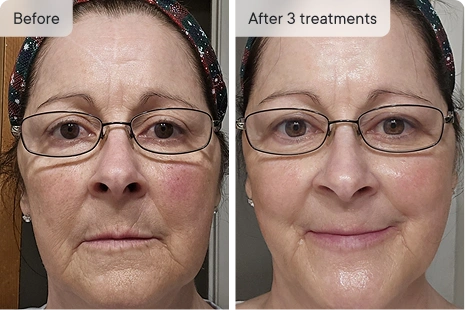 Before and after image