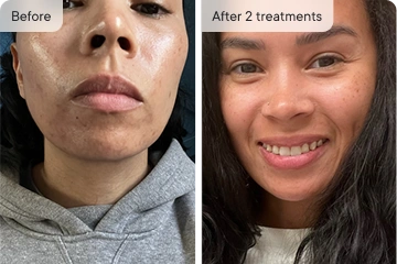 Amazing results!