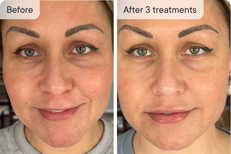 Thrilled with the results!