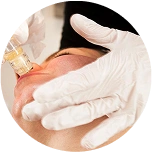 Micro-Infusion Clinic Treatment