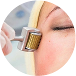 Derma Roller At-Home Treatment